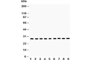 Western blot testing of PRDX3 antibody and Lane 1:  rat brain;  2: mouse brain;  3: rat skeletal muscle;  4: mouse skeletal muscle;  5: human U20S;  6: HeLa;  7: SMMC-7721;  8: RH35;  9: A549 lysate. (Peroxiredoxin 3 anticorps  (AA 110-256))