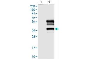 Western blot analysis of Lane 1: Negative control (vector only transfected HEK293T lysate), Lane 2: Over-expression Lysate (Co-expressed with a C-terminal myc-DDK tag (~3. (TTC19 anticorps)