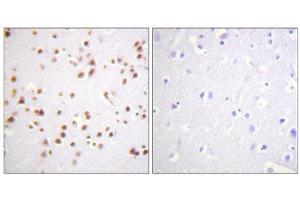 Immunohistochemistry (IHC) image for anti-Catenin (Cadherin-Associated Protein), delta 1 (CTNND1) (Tyr228) antibody (ABIN1848016) (CTNND1 anticorps  (Tyr228))