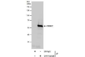 IP Image Immunoprecipitation of TRIM27 protein from Jurkat whole cell extracts using 5 μg of TRIM27 antibody, Western blot analysis was performed using TRIM27 antibody, EasyBlot anti-Rabbit IgG  was used as a secondary reagent. (TRIM27 anticorps)