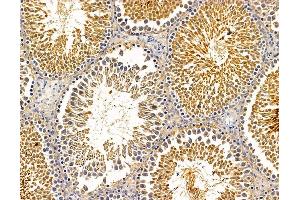 ABIN7095697 and ABIN7099759 at 1/100 staining mouse testis tissue by IHC-P. (MAN1A1 anticorps)