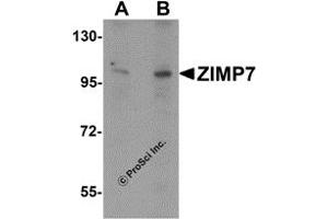 Western Blotting (WB) image for anti-Zinc Finger, MIZ-Type Containing 2 (ZMIZ2) (Middle Region) antibody (ABIN1031174) (ZMIZ2 anticorps  (Middle Region))
