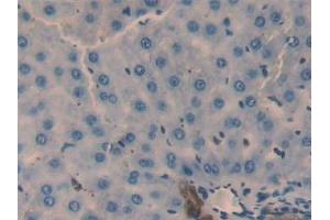 Detection of GAL2 in Rat Liver Tissue using Polyclonal Antibody to Galectin 2 (GAL2) (Gallinacin-2 (GAL2) (AA 1-130) anticorps)