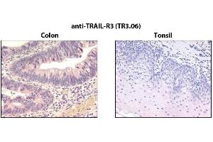 Immunohistochemistry detection of endogenous TRAIL-R3 in paraffin-embedded human carcinoma tissues (colon, tonsil) using mAb to TRAIL-R3 (TR3. (DcR1 anticorps)
