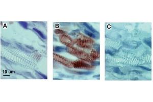 Immunohistochemistry (IHC) image for anti-Keyhole Limpet Hemocyanin (KLH) antibody (ABIN93503)