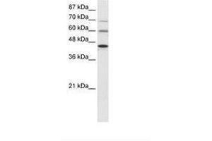 Image no. 1 for anti-Protein Arginine Methyltransferase 3 (PRMT3) (AA 221-270) antibody (ABIN6736023) (PRMT3 anticorps  (AA 221-270))