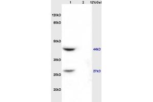 Lane 1: rat kidney lysates Lane 2: rat brain lysates probed with Anti AVPR2 Polyclonal Antibody, Unconjugated (ABIN674619) at 1:200 in 4 °C. (DIABLO anticorps  (AA 131-239))