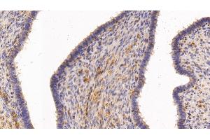 Detection of TGM2 in Human Uterus Tissue using Polyclonal Antibody to Transglutaminase 2 (TGM2) (Transglutaminase 2 anticorps  (AA 1-687))