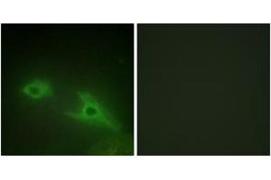 Immunofluorescence analysis of HeLa cells, using EPHA1 Antibody.