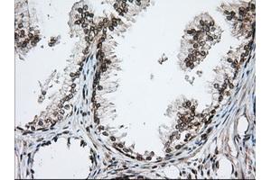 Immunohistochemical staining of paraffin-embedded Human pancreas tissue using anti-TACC3 mouse monoclonal antibody. (TACC3 anticorps)