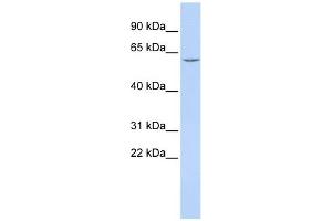 Carboxylesterase 7 antibody used at 1 ug/ml to detect target protein.