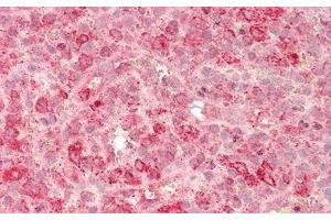 anti-Granulin (GRN) (AA 21-120) antibody