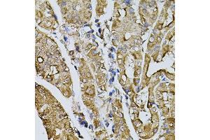 Immunohistochemistry of paraffin-embedded human stomach using MYL1 antibody. (MYL1 anticorps)