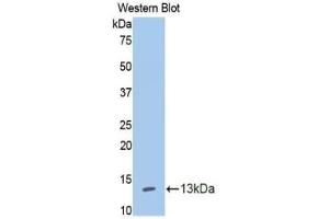 Western blot analysis of the recombinant protein. (IL13 Receptor alpha 1 anticorps  (AA 137-210))