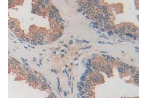 Detection of USP7 in Human Prostate Tissue using Polyclonal Antibody to Ubiquitin Specific Peptidase 7 (USP7)