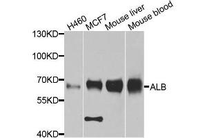 Western blot analysis of extracts of various cell lines, using ALB antibody. (Albumin anticorps  (AA 20-255))