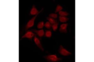 ABIN6267551 staining HeLa by IF/ICC. (STAT2 anticorps  (pTyr690))