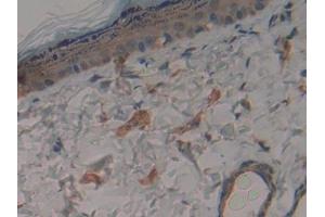 Detection of BFP in Rat Skin Tissue using Polyclonal Antibody to Brain Finger Protein (BFP)