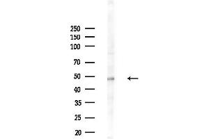 Western blot analysis of lysates from LoVo cells(heat-shock, 45 min treatment), using Phospho-HDAC3 (Ser424) Antibody at 1/1000 dilution.