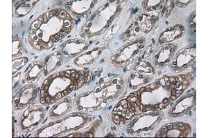 Image no. 1 for anti-Keratin 18 (KRT18) (AA 69-372) antibody (ABIN1491639)