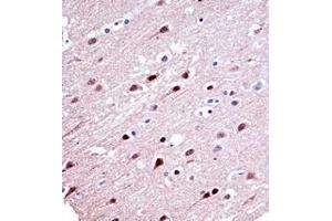 Immunohistochemistry analysis in formalin fixed and paraffin embedded human brain tissue reacted with  KCND2 Antibody (N-term) followed which was peroxidase conjugated to the secondary antibody and followed by DAB staining. (KCND2 anticorps  (N-Term))
