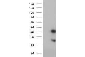 Western Blotting (WB) image for anti-Frataxin (FXN) antibody (ABIN1498335) (Frataxin anticorps)