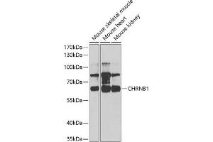 Western blot analysis of extracts of various cell lines, using CHRNB1 antibody (ABIN6131211, ABIN6138587, ABIN6138588 and ABIN6220911) at 1:1000 dilution.