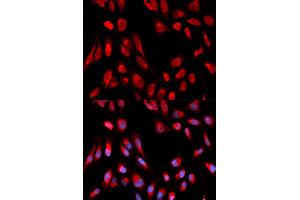 Immunofluorescence (IF) image for anti-Hydroxysteroid (17-Beta) Dehydrogenase 10 (HSD17B10) antibody (ABIN1876636) (HSD17B10 anticorps)
