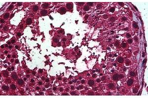 Human Testis: Formalin-Fixed, Paraffin-Embedded (FFPE)