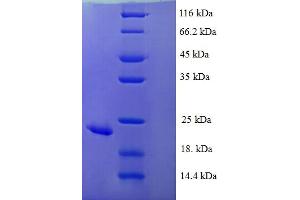 SDS-PAGE (SDS) image for Kruppel-Like Factor 6 (KLF6) (AA 27-207) protein (His tag) (ABIN5711006)