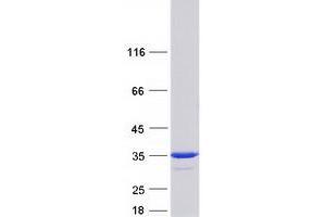 Validation with Western Blot