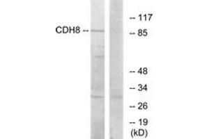 Western Blotting (WB) image for anti-Cadherin 8 (CDH8) (AA 491-540) antibody (ABIN2889888) (Cadherin 8 anticorps  (AA 491-540))
