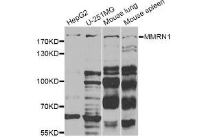 Western blot analysis of extracts of various cell lines, using MMRN1 Antibody. (Multimerin 1 anticorps)
