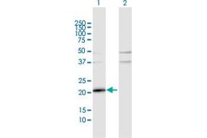 Western Blot analysis of TMEM126B expression in transfected 293T cell line by TMEM126B MaxPab polyclonal antibody. (TMEM126B anticorps  (AA 1-200))