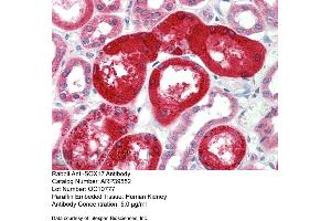 Rabbit Anti-SOX17 Antibody  Paraffin Embedded Tissue: Human Kidney Antibody Concentration: 5 ug/ml (SOX17 anticorps  (Middle Region))