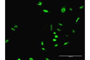 Immunofluorescence of purified MaxPab antibody to SCML1 on HeLa cell. (SCML1 anticorps  (AA 1-208))
