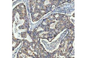 IHC analysis of TOMM20 using anti-TOMM20 antibody (ABIN7600883). (TOMM20 anticorps  (AA 25-145))