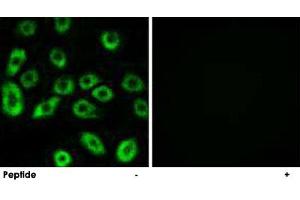 Immunofluorescence analysis of A-549 cells, using ATP5D polyclonal antibody . (ATP5F1D anticorps)