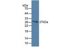 Detection of Recombinant DBP, Human using Monoclonal Antibody to Vitamin D Binding Protein (DBP)