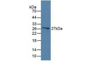 Detection of Recombinant DBP, Human using Monoclonal Antibody to Vitamin D Binding Protein (DBP) (Vitamin D-Binding Protein anticorps  (AA 209-401))