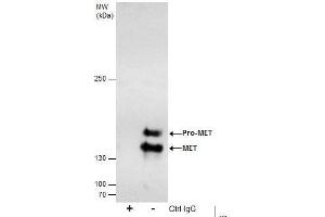 IP Image Immunoprecipitation of c-Met protein from HeLa whole cell extracts using 5 μg of c-Met antibody [C3], C-term, Western blot analysis was performed using c-Met antibody [C3], C-term, EasyBlot anti-Rabbit IgG  was used as a secondary reagent.