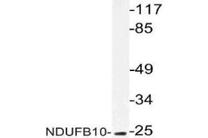 Western blot (WB) analysis of NDUFB10 antibody in extracts from COLO cells. (NDUFB10 anticorps)