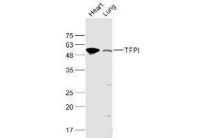 Lane 1: Mouse Heart lysates Lane 2: Rat Lung lysates probed with TFPI Polyclonal Antibody, Unconjugated  at 1:1000 dilution and 4˚C overnight incubation.