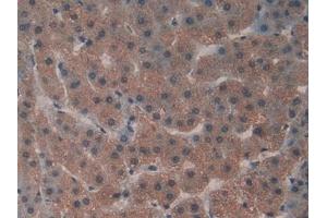 Detection of GaA in Human Liver Tissue using Polyclonal Antibody to Glucosidase Alpha, Acid (GaA)