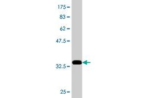 Western Blot detection against Immunogen (37. (CDR2 anticorps  (AA 296-404))