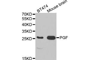 Western Blotting (WB) image for anti-Placenta Growth Factor (PGF) antibody (ABIN1874109) (PLGF anticorps)