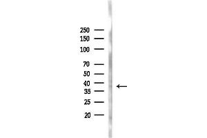 anti-F-Box Protein 32 (FBXO32) (N-Term) antibody