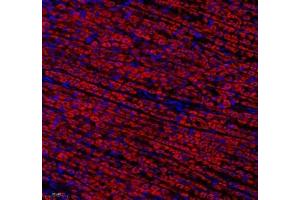 Immunofluorescence of paraffin embedded rat stomach using ATP5A1 (ABIN7073141) at dilution of 1: 300 (200x lens)