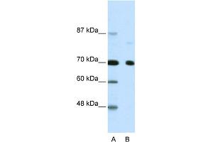 WB Suggested Anti-NCOR2 Antibody Titration:  2. (NCOR2 anticorps  (N-Term))