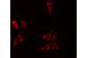 ABIN6275994 staining  HuvEc cells by IF/ICC.